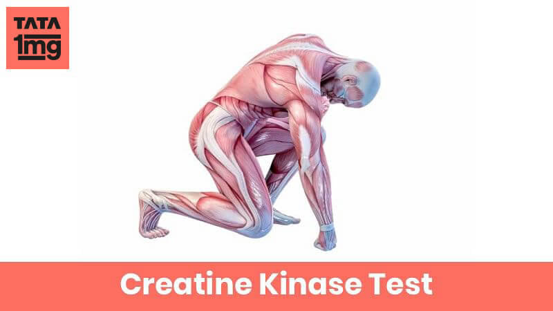 Creatine Kinase